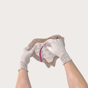 Krok 2 aplikacji Mepilex Border Sacrum
